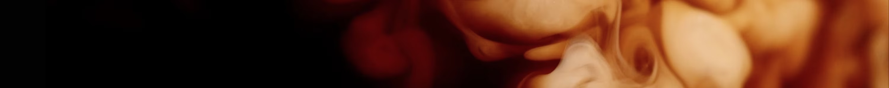 PACKS PROMO banner